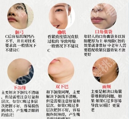 北京张春彦面吸技术好不好?真人案例图展示!来看对比