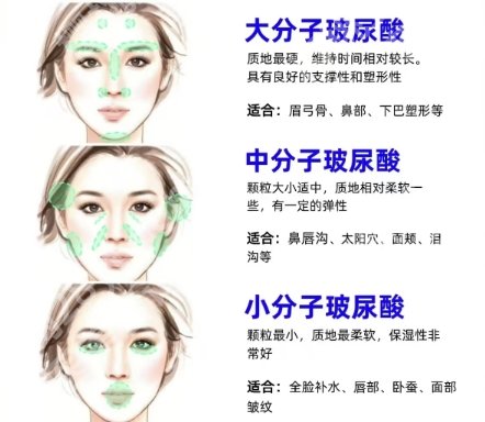彭才学怎么样？做垫下巴技术如何？真人近期案例反馈！