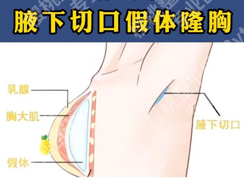 广州唐志荣隆胸怎么样？医生介绍、明星项目、坐诊医院信息曝光！