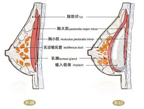 广州唐志荣隆胸怎么样？医生介绍、明星项目、坐诊医院信息曝光！