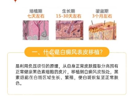 广医一院整形外科有植皮手术吗？医院口碑评价来袭！