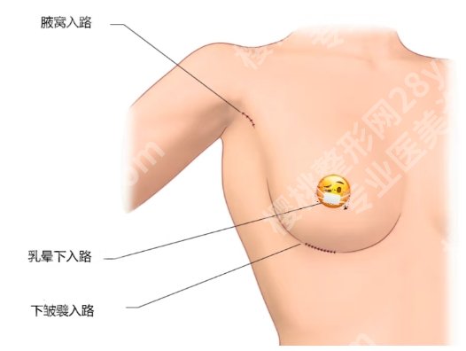 唐志荣隆胸修复怎么样？医生基本信息|擅长项目|价格表出炉！