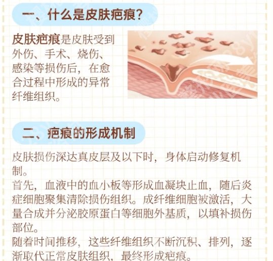 吉大一院整形科去除疤痕怎么样？术后网友真实案例分享！附术后小tips！