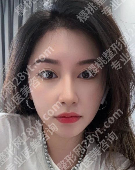北京304医院植发怎么预约？附医院亮点及真实案例