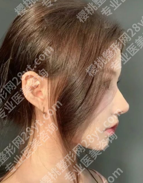 2025宁波做鼻子好的医生有哪些？叶巍、汪发生、顾陆健等值得选！