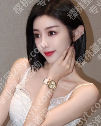 上海做下颌角*好的医生有谁？李湘原、何晋龙、李志海等医生技术梗核！
