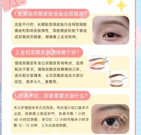 关小康双眼皮案例图一览|做得好不好一看便知！内附25年价格明细