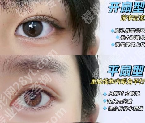 关小康双眼皮案例图一览|做得好不好一看便知！内附25年价格明细
