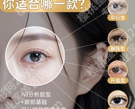 范希玲修复双眼皮案例以及价格明细曝光！来看前后变化！戳进来看