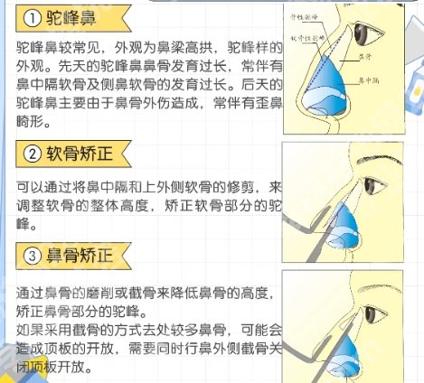 卿勇歪鼻矫正技术、口碑反馈更新！顾客真实测评来袭！