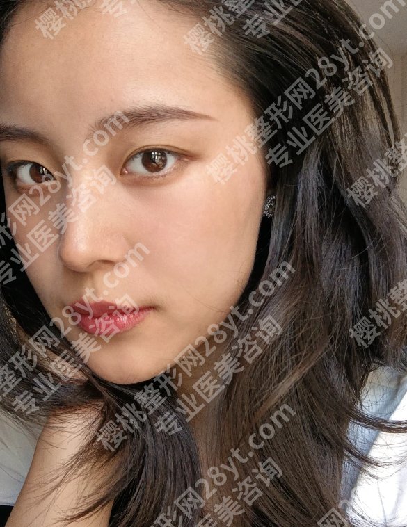 北京和颜杨瑞锋医生怎么样？附详细介绍及口碑点评