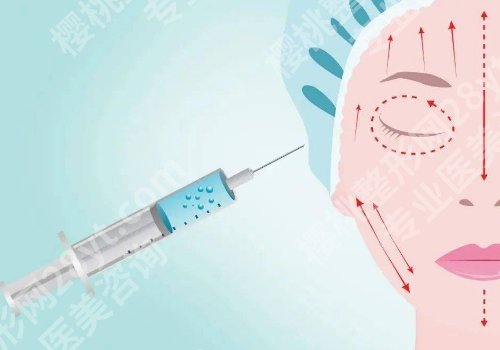 北京钱宁注射物取出专业吗？医生信息、网友反馈、近期案例及手术小贴士分享