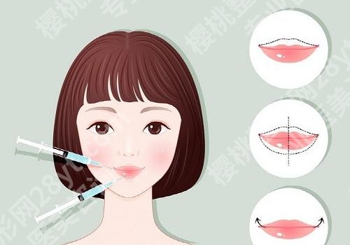 北京朱金成做嘴唇怎么样？面诊过程及价格参考