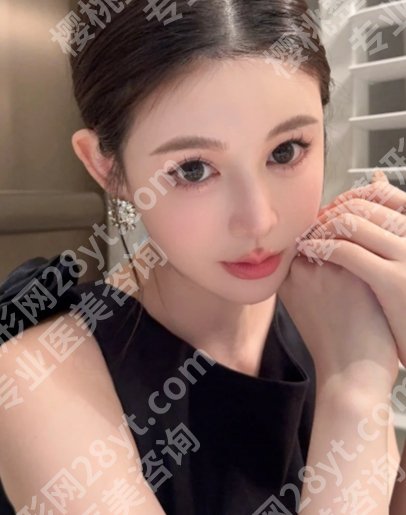 南昌易阳艳割双眼皮案例多吗！医生简介、网友反馈、项目介绍及面诊小技巧分享