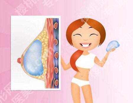 孙湄杨做隆胸怎么样？案例细节查看，在线预览2025价格表信息