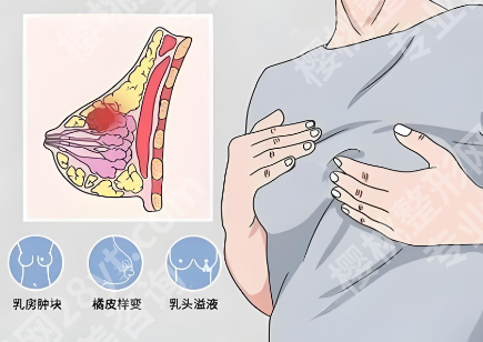唐志荣医生做隆胸好吗？预约面诊流程怎么样？更新项目价目