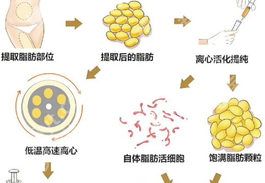 周珍艳隆胸怎么样？了解医生简介与面诊过程查看