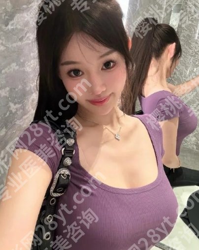 才杰医生丰乳手术案例欣赏！医生技术点评、口碑评价、价格公开及术后小tips