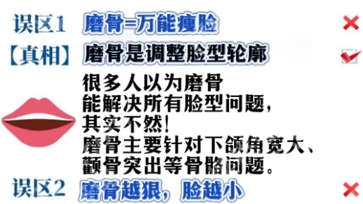 邱立东医生做磨骨整形怎么样？面诊诉求方案分析|案例效果分享！