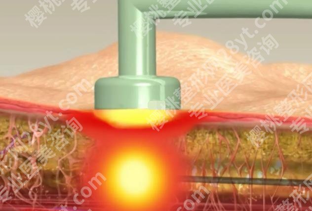 重庆星荣整形外科医院吸脂价格贵不贵？基本信息|一站式掌握