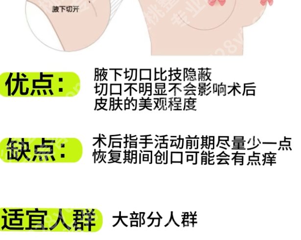 马静医生隆胸怎么样？医生个人资料介绍！附院内特色项目推荐！就诊必看！