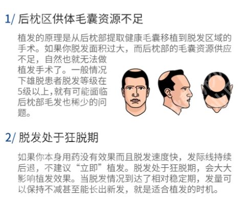 北京大学人民医院植发价格一览表！附真实案例鉴赏！速速码住！