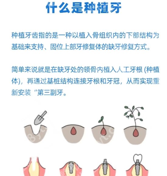 北京大学深圳医院种植牙齿好贵！医院基本信息介绍！附医生简介！