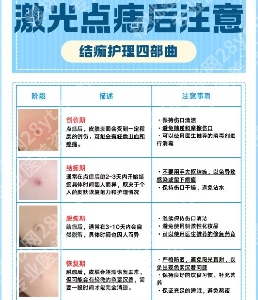 深圳人民医院激光点痣多少钱？内附医院亮点！有完整的服务体系！