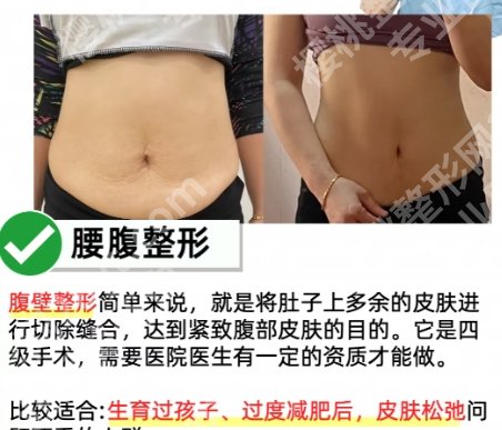重庆腰腹吸脂哪里好？2025医院排行榜出炉！收藏再看