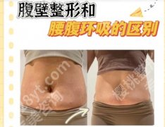 重庆腰腹部吸脂价格贵不贵？多少钱？2025全新收费标准+案例更新