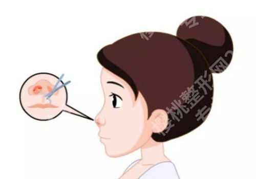 曾德浩医生怎么样？在那家医院？技术优势、25年价格表参考