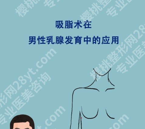 南京男性胸部整形不错的有哪几家？当地网友力荐名单公布！