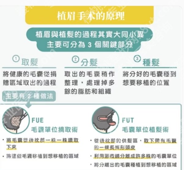 郭镇合医生植眉毛怎么样？真人植发面诊过程分享！
