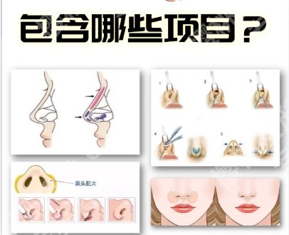 上海玻尿酸隆鼻去哪家医院好？2025医院排行榜名单公布