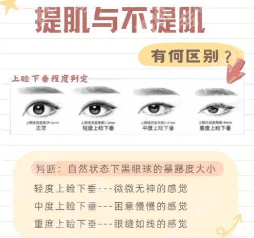 吴红丽做双眼皮好吗？附医生基本信息介绍！附术前、术后小贴士！