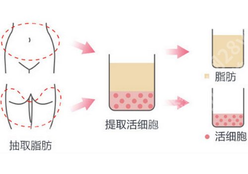 万友望隆胸怎么样？那家医院坐诊？技术优势、疑问解答