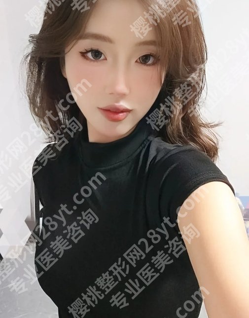 2025上海六院缩胸手术费用是多少？低至2.7w左右起！性价比高！