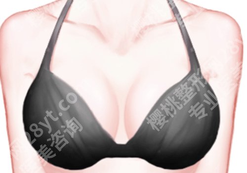北京陈育哲医生个人简介！隆胸技术一绝，实力口碑大揭秘！