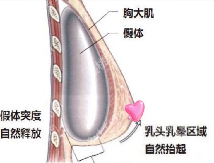 穆大力医生口碑怎么样？做隆胸技术如何？案例展示！