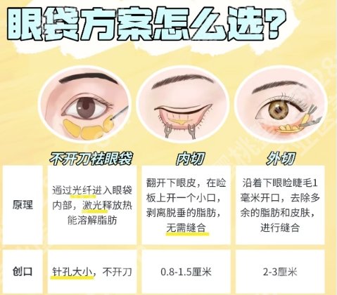 上海第十人民医院去眼袋怎么样？技术点评来了！