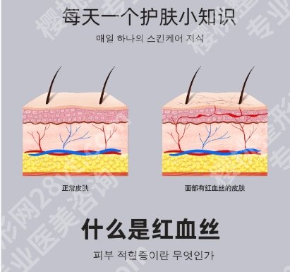 北京协和医院激光科虎丽军医生口碑如何？技术靠谱吗？