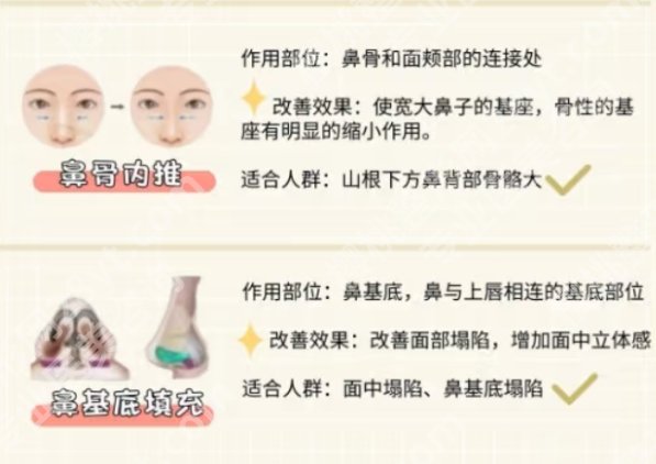 深圳刘波做鼻子到底怎么样？网友肋软骨隆鼻经验分享，评价很高！