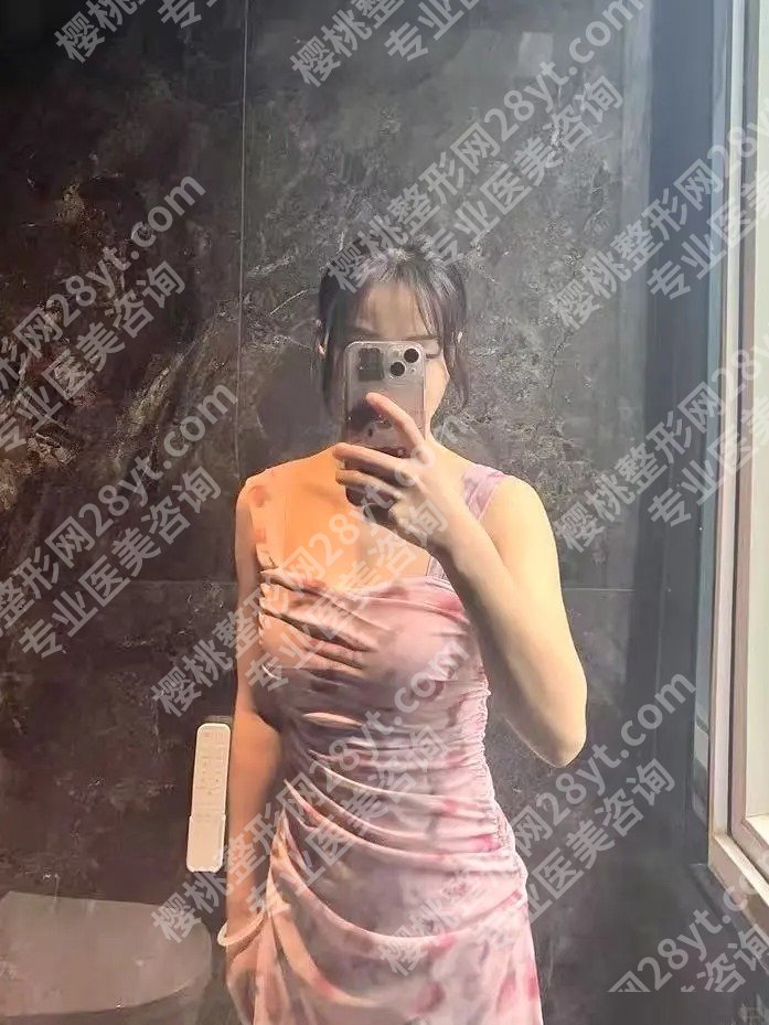 哈尔滨医大一院缩胸挂什么科？整形外科！科室亮点及顾客反馈展示