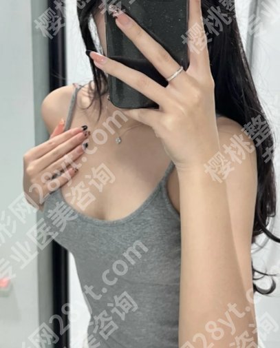 宁波第二医院缩胸多少钱？2025年更新起步价4W+左右起！技术口碑没的挑