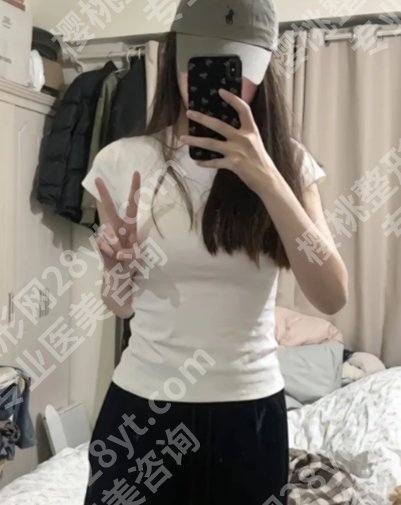 苏州市立医院缩胸手术费用是多少？2025参考价格3到10万左右！看完闭眼冲