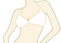 浙江医院缩胸手术费用：大概在2.7w起；真实网友反馈来袭！