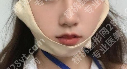 广州下颌角肥大医院排名曝光!戳进来看真实的顾客点评吧