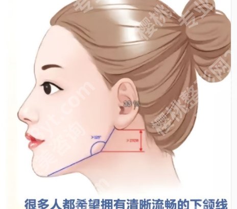 合肥下颌角削骨过度怎么能补？哪个医生好？人气名单公布！