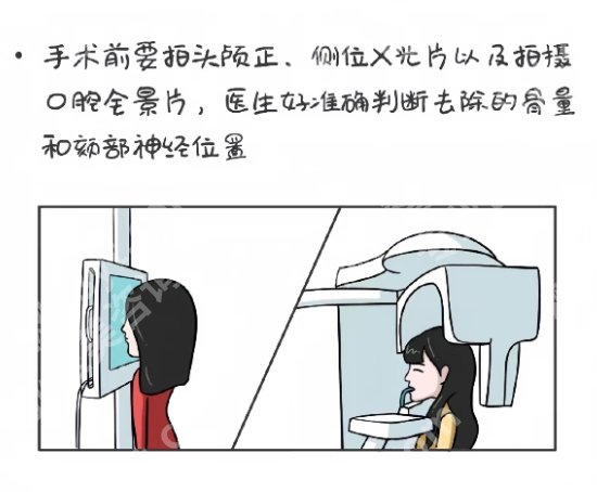 2025年上海磨下颌角价格表一览！内附医生简介及就诊医院！