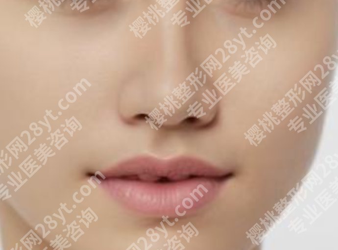 广州郭栋适合做什么样的鼻型？真人鼻部整形案例参考